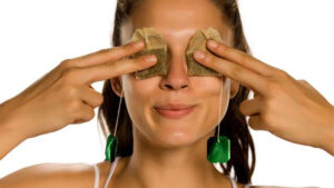 Dark circle under the eye, causes, prevention, risk factors and its treatment.